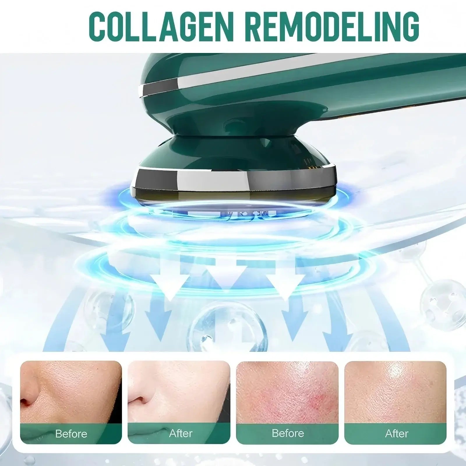 Masajeador Facial Multifunción